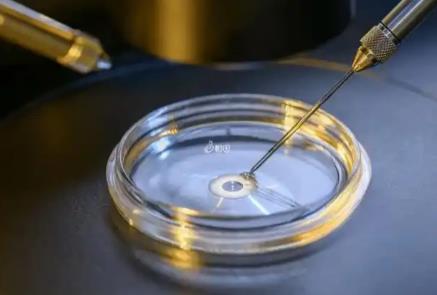 人工助孕与试管区别